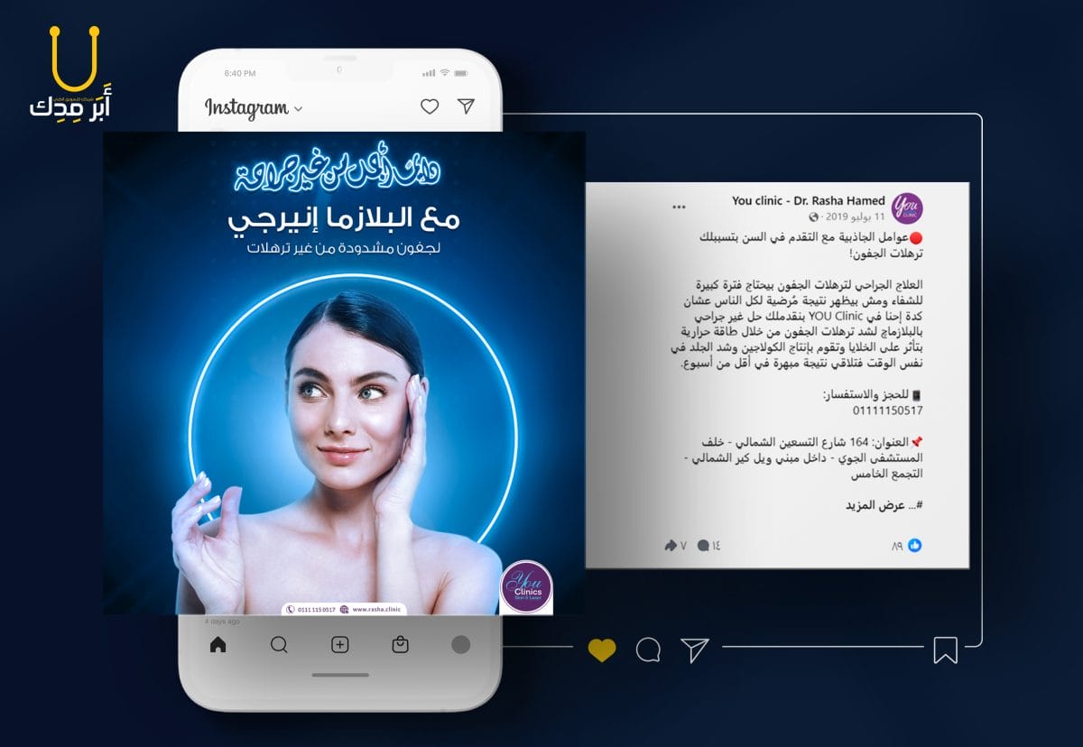 أفكار حملات إعلانات إبداعية لمنصات التواصل من أعمالنا - أفكار حملات إعلانات إبداعية لمنصات التواصل من أعمالنا